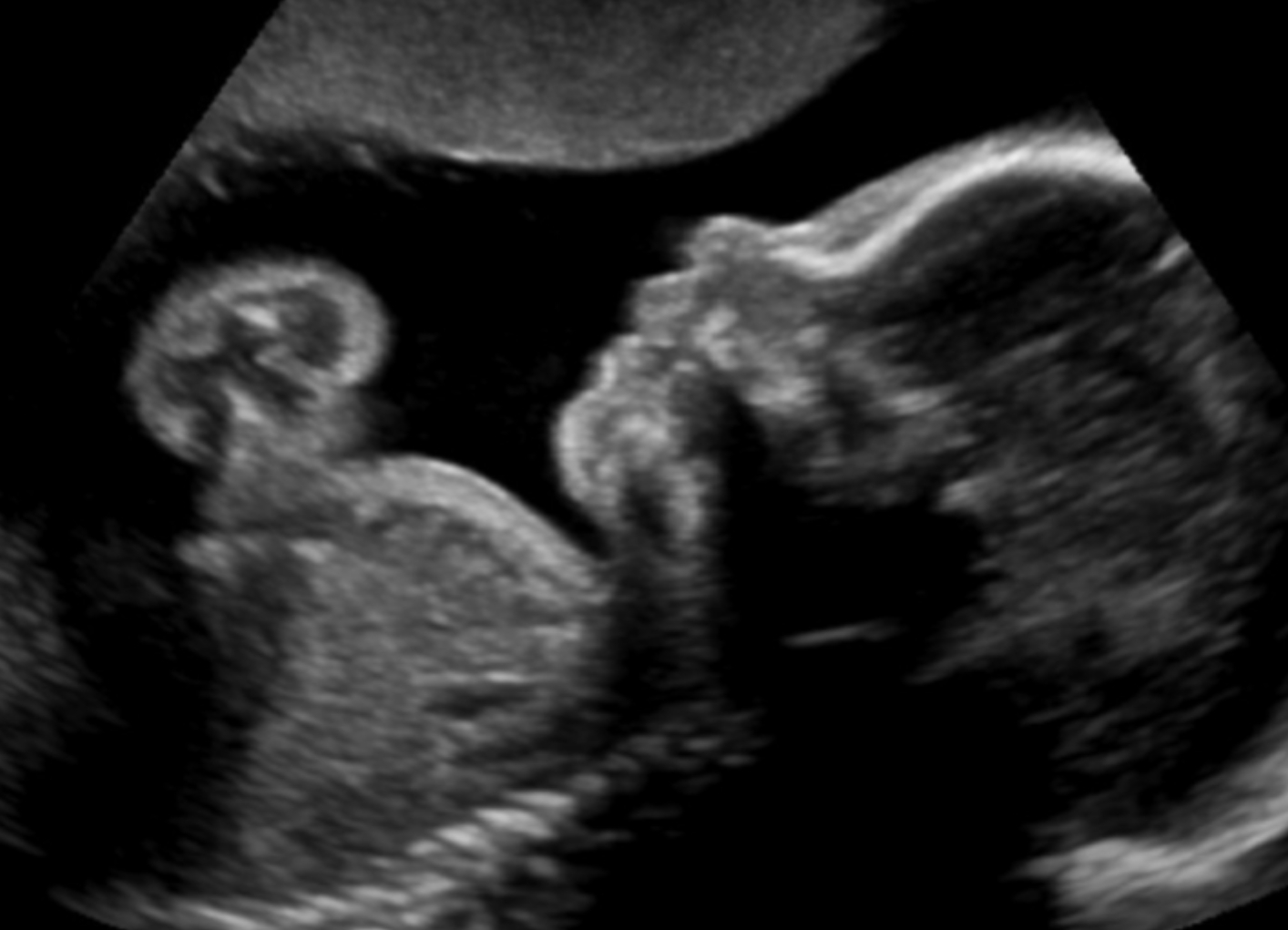 If Wombs had Windows:  The Journey of Pro-Life Utah's Ultrasound Van